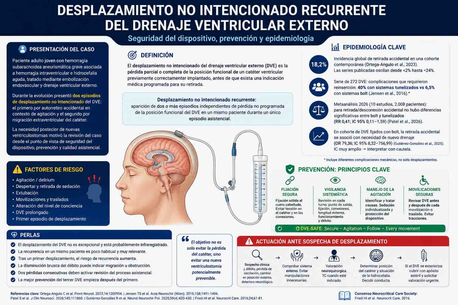 Desplazamiento no intencionado recurrente del drenaje ventricular externo en hemorragia subaracnoidea aneurismática